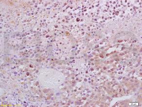 ����ALL����ϣ������CRA-Tϸ������