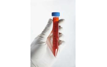 ��������Լ�׷�������