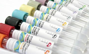 ��⣺�ϰ����Ƽ���֧�����ô���ת��