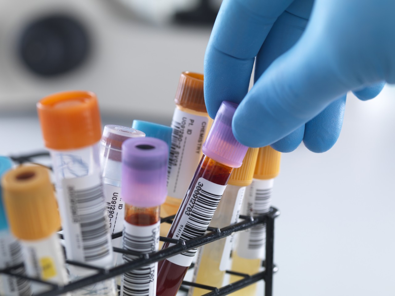 ���ܳ����վɡ�BE���������ٴ���Ч�����׼��