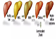 ̸��ɫ��β�NASH��̽��֮·