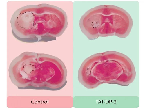 ½«TAT-PP-2×¢ÉäÈëСÊóÌåÖоÙÐÐʵÑé ½«TAT-PP-2×¢ÉäÈëСÊóÌåÖоÙÐÐʵÑé