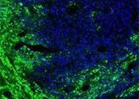 ��Эʵ��������������CAR-T��������ʵ�����������˼��