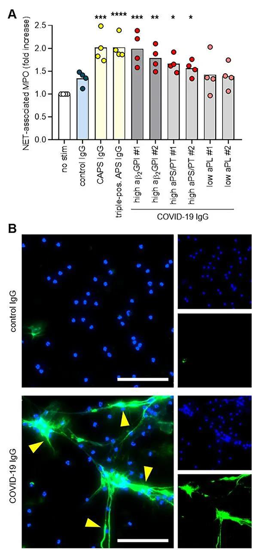 COVID-19IgGϸͷNET